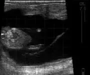 Bovine Fetus approx 71 days