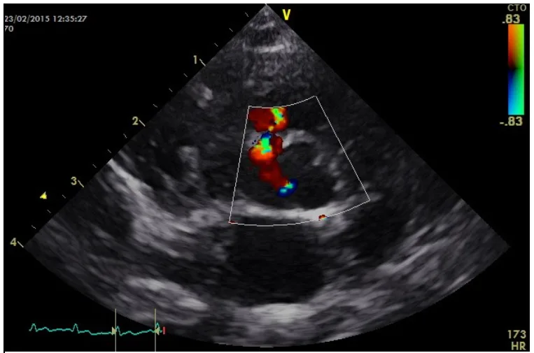 Colour doppler image at Cheshire Cardiology