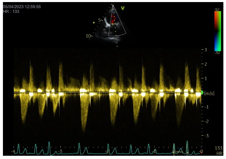 Continuous wave doppler image , taken by Dave Dickson at Heart Vets