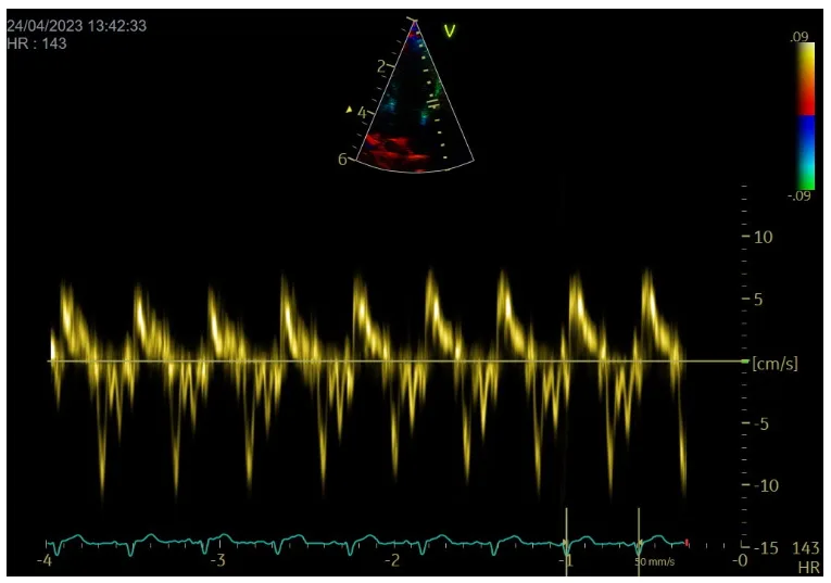 Tissue doppler image courtesy , taken by Dave Dickson at Heart Vets